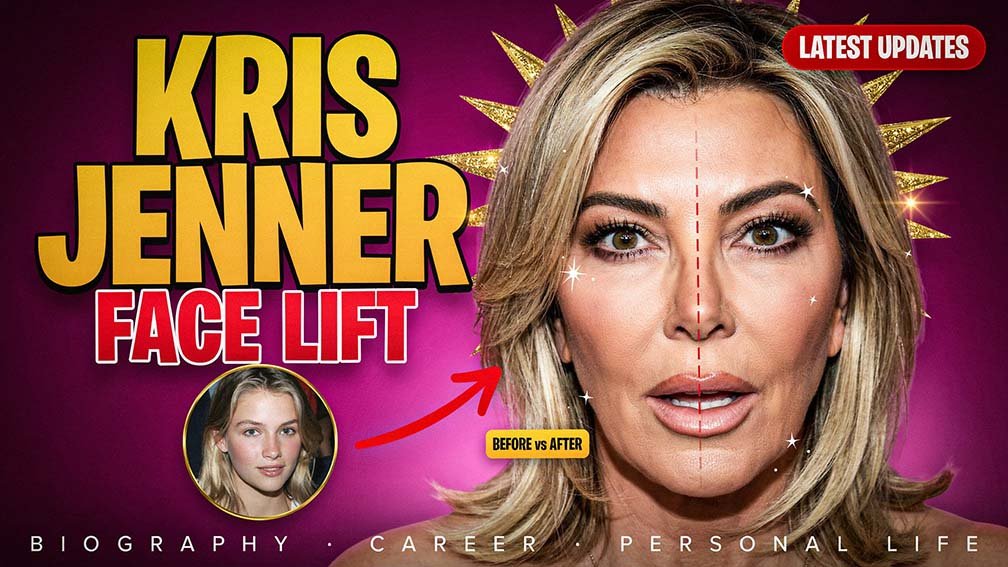 Kris Jenner Face Lift: Biography, Career, Personal Life, and Latest Updates